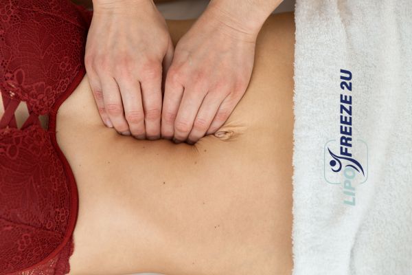 diastasis recti treatment Bushey