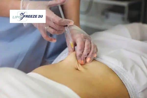How Does Aqualyx Fat Dissolving Injection Work to Break Down Fat Bushey?