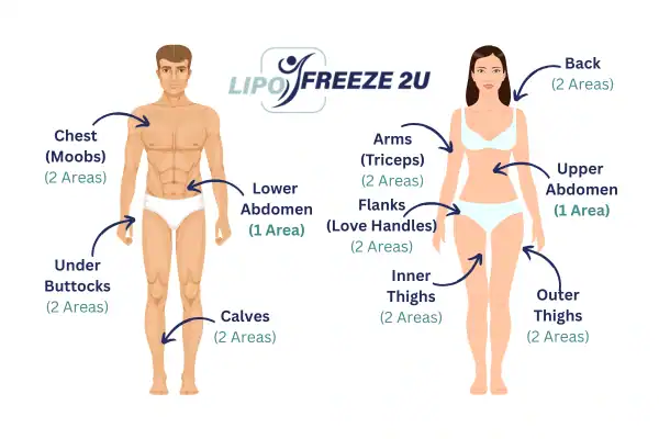 Areas you can have fat freezing treatment Bushey