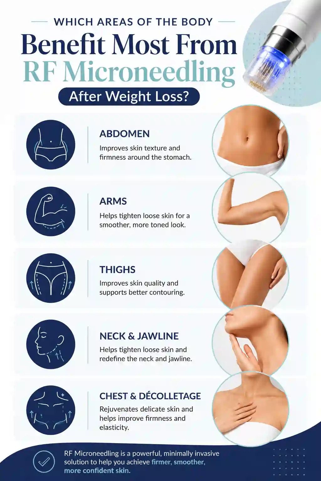 Which Areas of the Body Benefit Most From RF Microneedling After Weight Loss Bushey